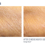 AlphaRet Body Overnight Cream