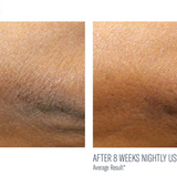 AlphaRet Body Overnight Cream