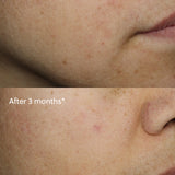 Vitamin C+ Serum