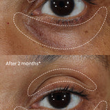 Vitamin C+ Eye Cream