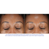 Extra Strength Active Peel Brightening System
